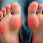 un podólogo explica los efectos negativos que el uso de zapatos estrechos todo el día puede causar en tus pies y cómo prevenir daños.